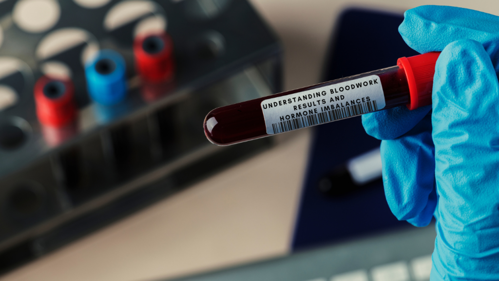 A phlebotomist holding a vial of blood for blood testing.